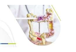 Microbiota intestinal: qué es y cómo ayudan los probióticos